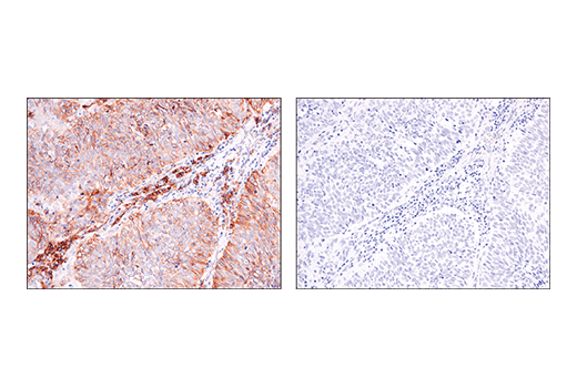 Immunohistochemistry Image 2: ASCT2 (D7C12) Rabbit mAb (BSA and Azide Free)