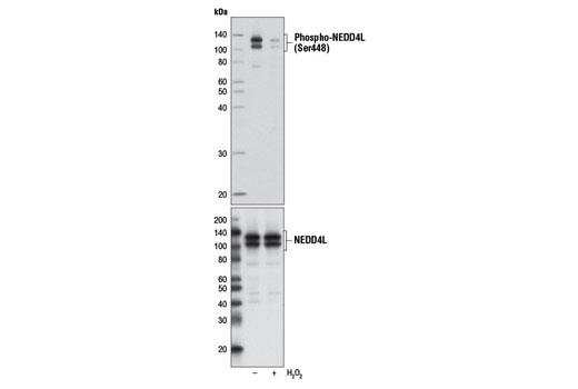 Western Blotting Image 1: Phospho-NEDD4L (Ser448) Antibody
