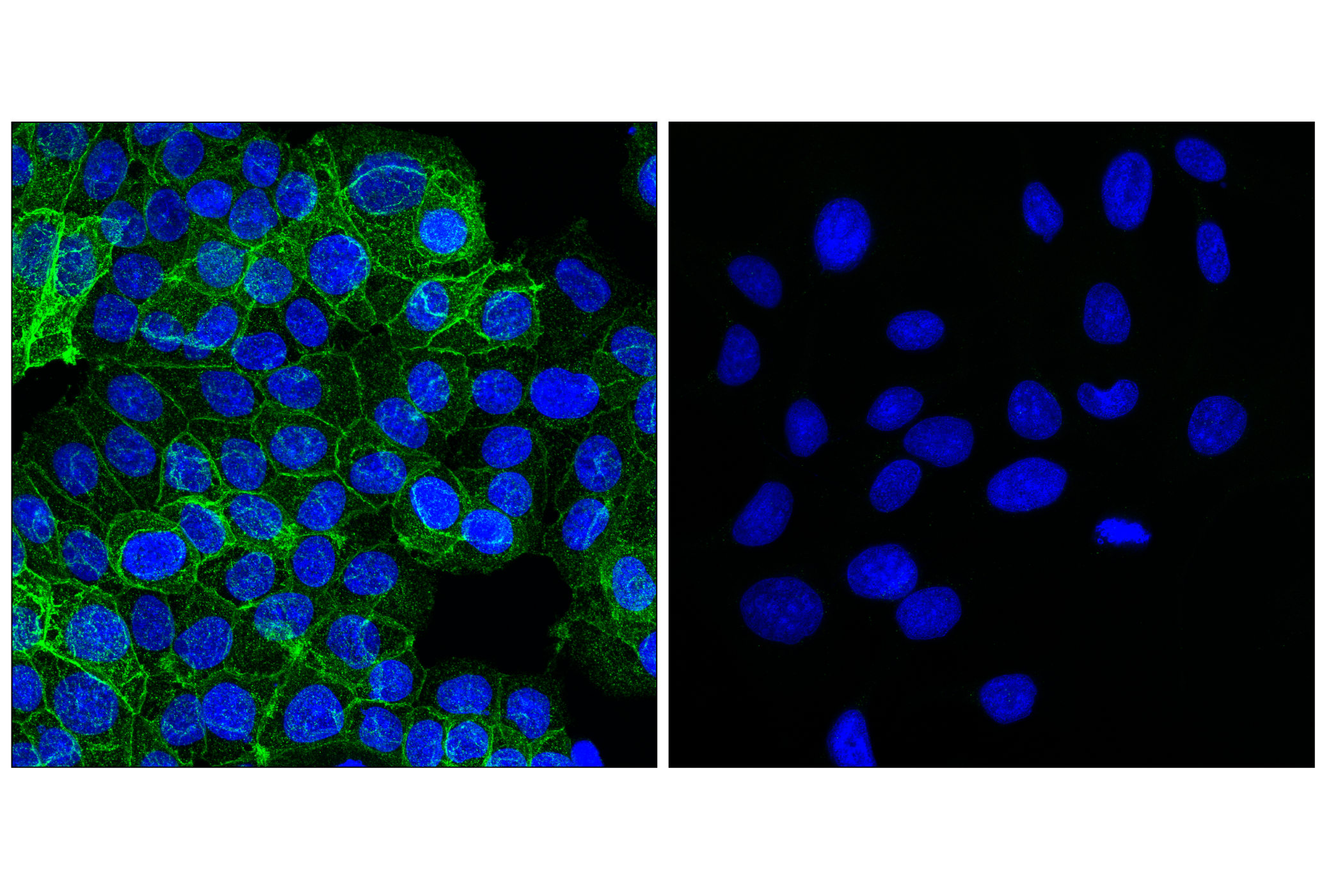 Immunofluorescence Image 1: SLC40A1/Ferroportin-1 (F4A2M) Rabbit mAb
