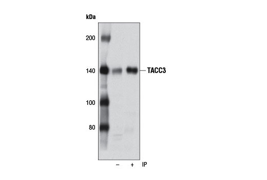 Immunoprecipitation Image 1: TACC3 (D9E4) XP® Rabbit mAb