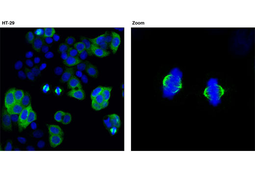 Immunofluorescence Image 1: TACC3 (D9E4) XP® Rabbit mAb