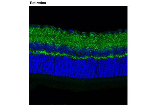 Immunofluorescence Image 1: AMPA Receptor 4 (GluA 4) (D41A11) XP® Rabbit mAb