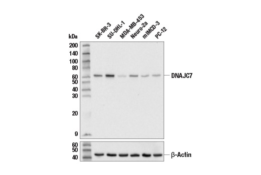 Western Blotting Image 1: DNAJC7 Antibody