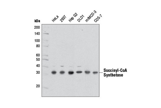 Western Blotting Image 1: Succinyl-CoA Synthetase (D8A11) Rabbit mAb