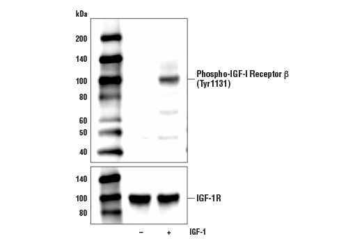 Western Blotting Image 1: Phospho-IGF-I Receptor β (Tyr1131)/Insulin Receptor β (Tyr1146) (D6D5L) Rabbit mAb