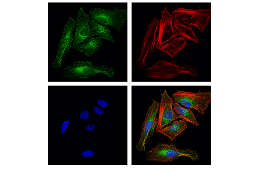 Immunofluorescence Image 1: Rab5A (E6N8S) Mouse mAb (BSA and Azide Free)