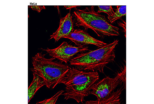 Immunofluorescence Image 1: TFAM (D5C8) Rabbit mAb