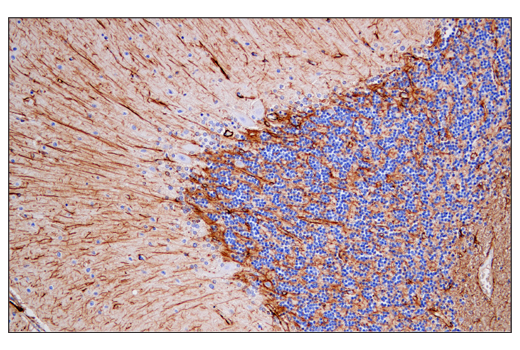  Image 2: Astrocyte Markers Antibody Sampler Kit