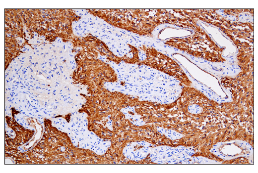  Image 29: Astrocyte Markers Antibody Sampler Kit