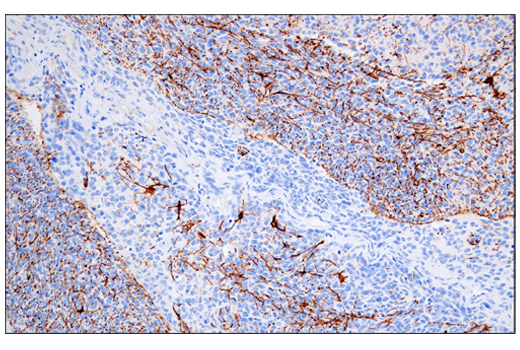  Image 31: Astrocyte Markers Antibody Sampler Kit