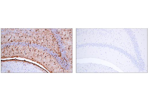  Image 37: Astrocyte Markers Antibody Sampler Kit