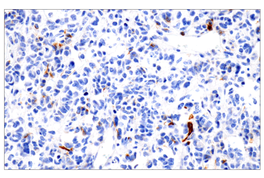  Image 14: Astrocyte Markers Antibody Sampler Kit