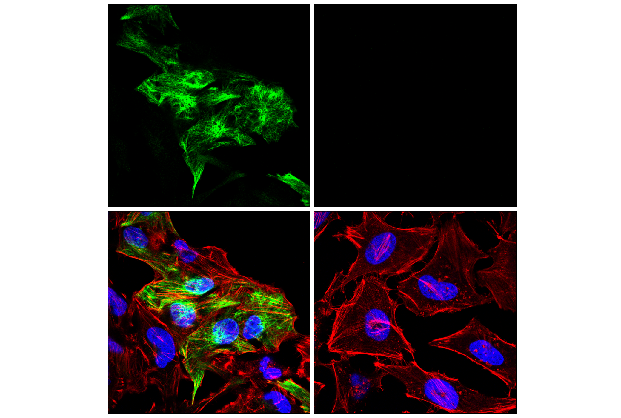 Immunofluorescence Image 2: GFAP (E4L7M) XP® Rabbit mAb