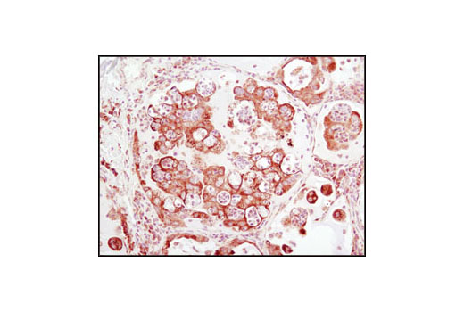 Immunohistochemistry Image 1: PDI (C81H6) Rabbit mAb (BSA and Azide Free)
