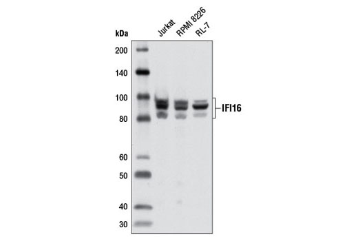 Western Blotting Image 1: IFI16 Antibody
