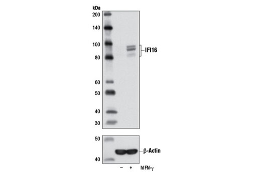 Western Blotting Image 2: IFI16 Antibody
