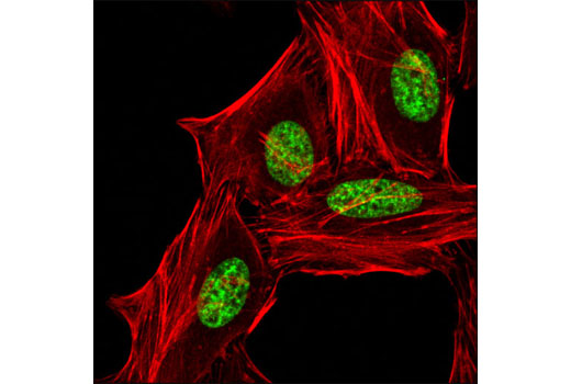 Immunofluorescence Image 1: Di-Methyl-Histone H3 (Lys9) (D85B4) XP® Rabbit mAb (BSA and Azide Free)