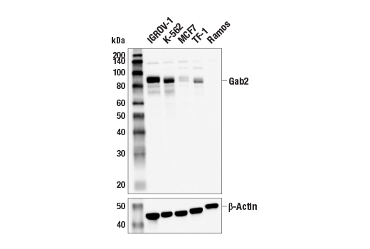 Western Blotting Image 1: Gab2 Antibody