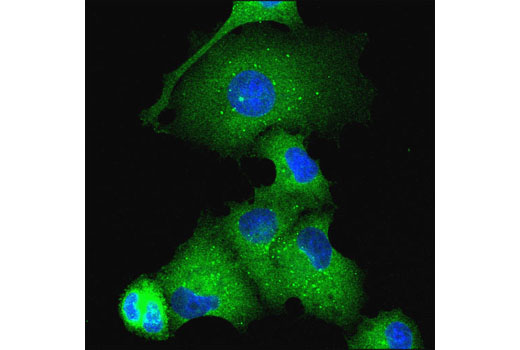 Immunofluorescence Image 1: Atg16L1 (D6D5) Rabbit mAb