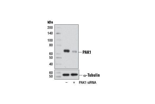  Image 1: SignalSilence® PAK1 siRNA I (Mouse Specific)