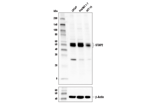 Western Blotting Image 1: STAP2 Antibody