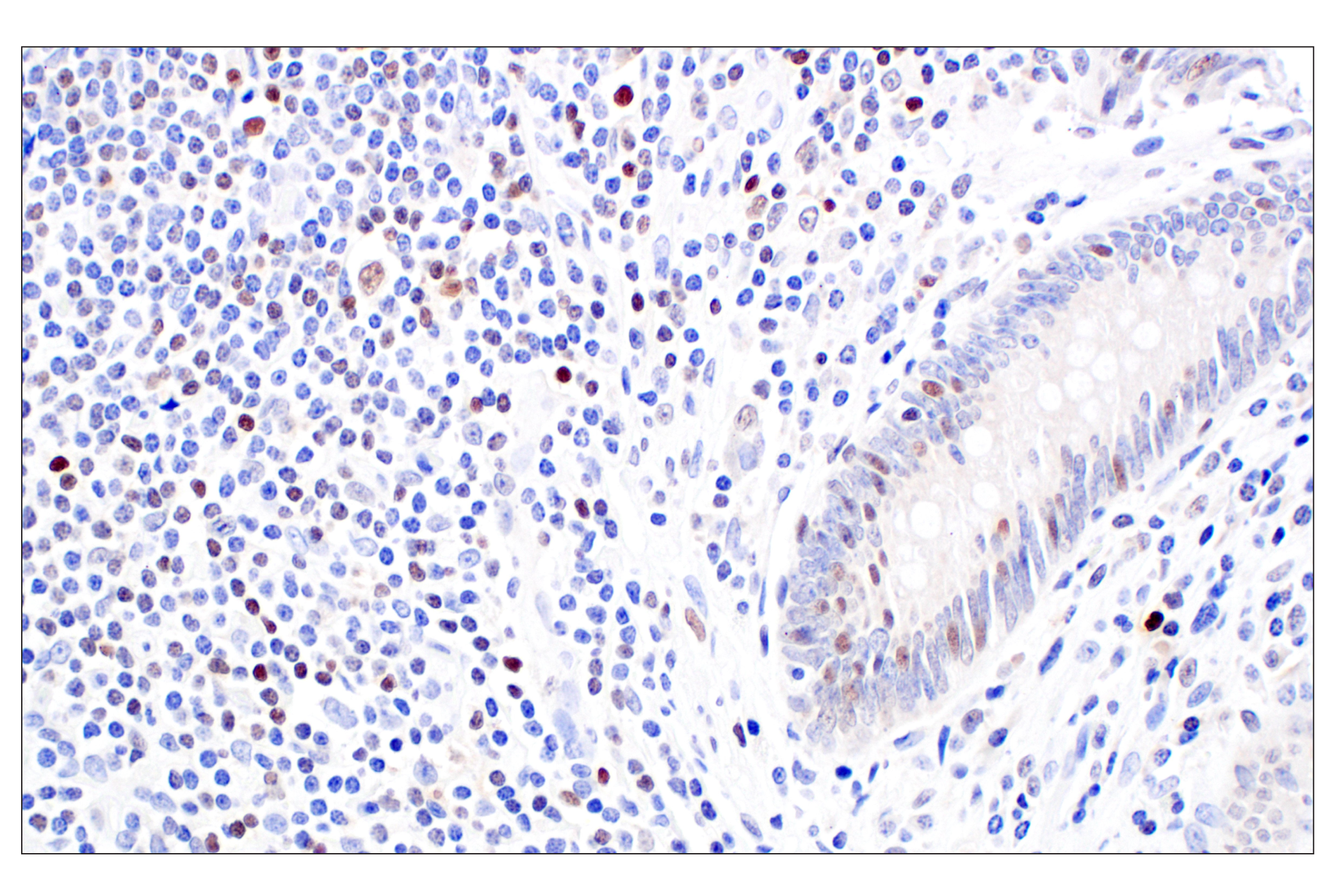 Tox (NAN448B) Rat Monoclonal Antibody | Cell Signaling Technology