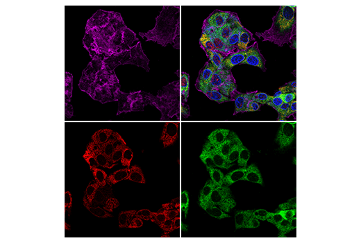 Immunofluorescence Image 1: ERp29 (E6A1G) Rabbit mAb