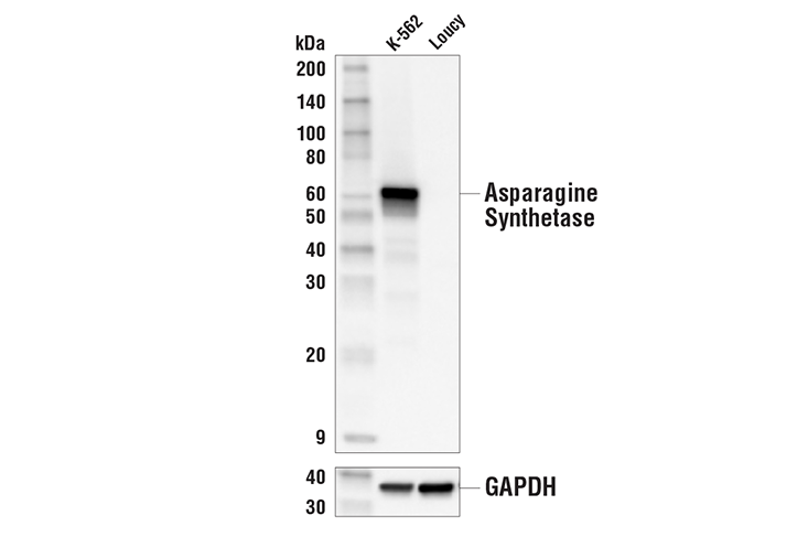 Western Blotting Image 1: Asparagine Synthetase (E6C2C) XP® Rabbit mAb (BSA and Azide Free)