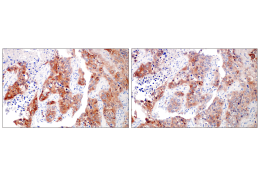 Immunohistochemistry Image 3: Asparagine Synthetase (E6C2C) XP® Rabbit mAb (BSA and Azide Free)