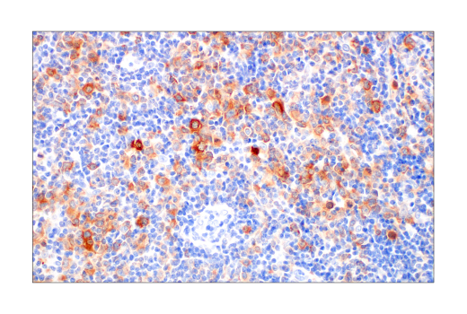 Immunohistochemistry Image 4: Asparagine Synthetase (E6C2C) XP® Rabbit mAb (BSA and Azide Free)