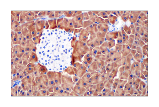 Immunohistochemistry Image 8: Asparagine Synthetase (E6C2C) XP® Rabbit mAb (BSA and Azide Free)
