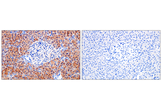 Immunohistochemistry Image 11: Asparagine Synthetase (E6C2C) XP® Rabbit mAb (BSA and Azide Free)