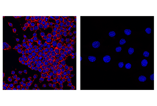 Immunofluorescence Image 2: CD45 (D3F8Q) Rabbit mAb (Alexa Fluor® 647 Conjugate)