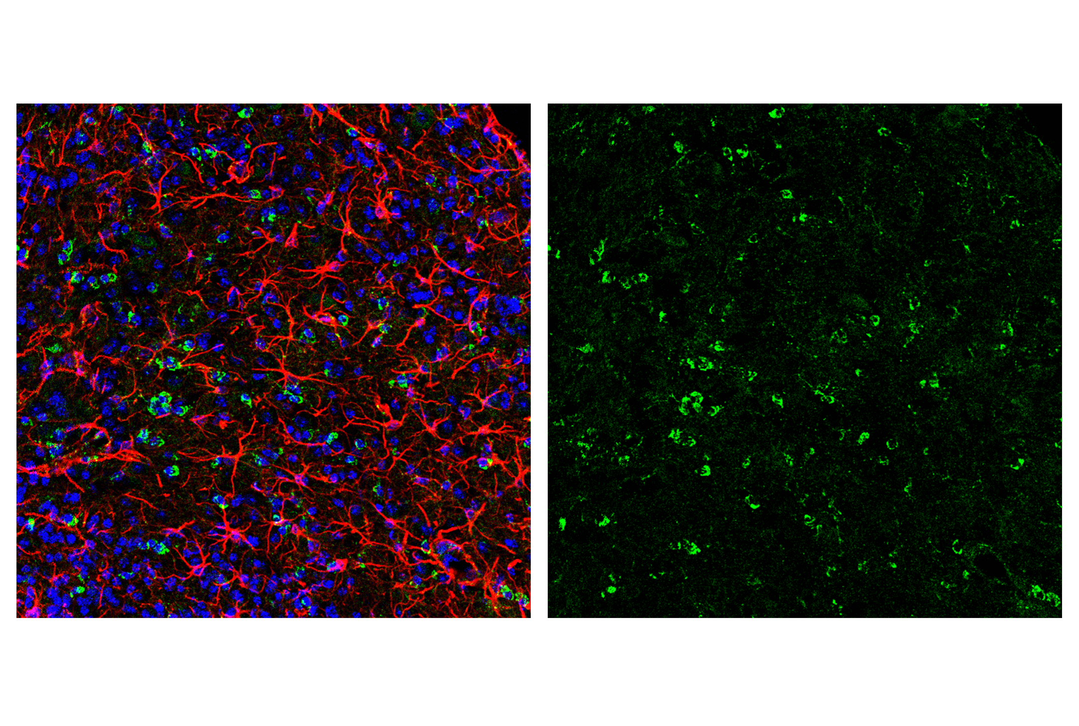 Immunofluorescence Image 7: Smac/Diablo (D5S3R) Rabbit mAb (BSA and Azide Free)