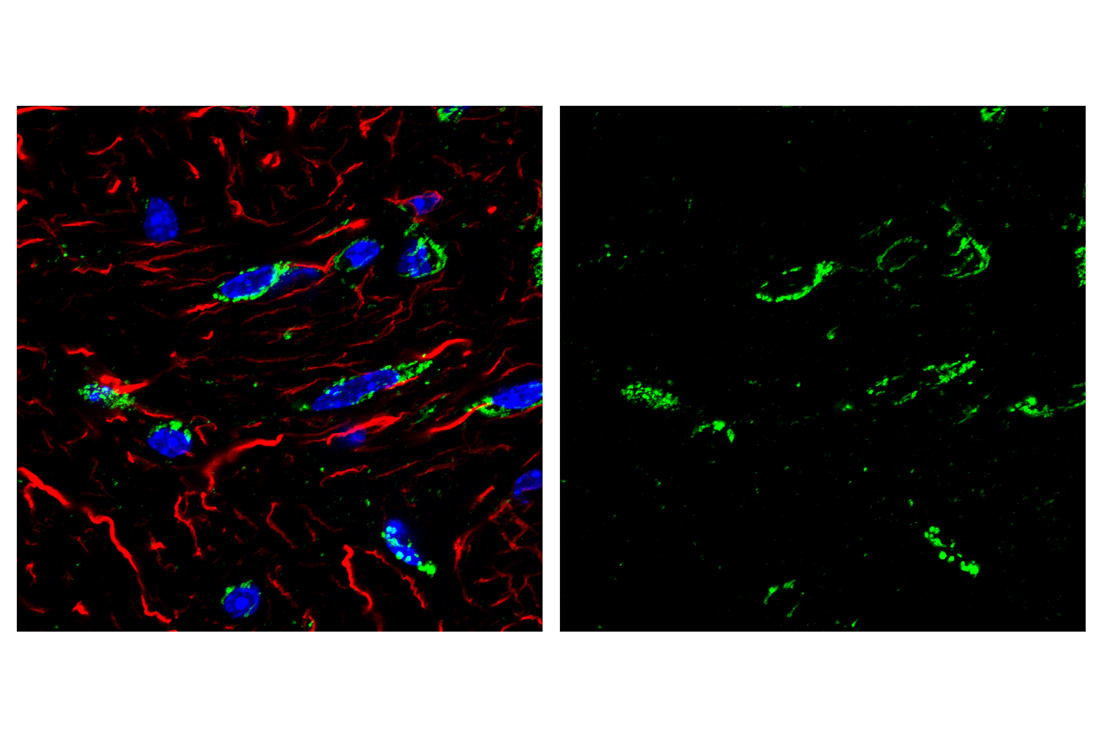 Immunofluorescence Image 1: Smac/Diablo (D5S3R) Rabbit mAb (BSA and Azide Free)