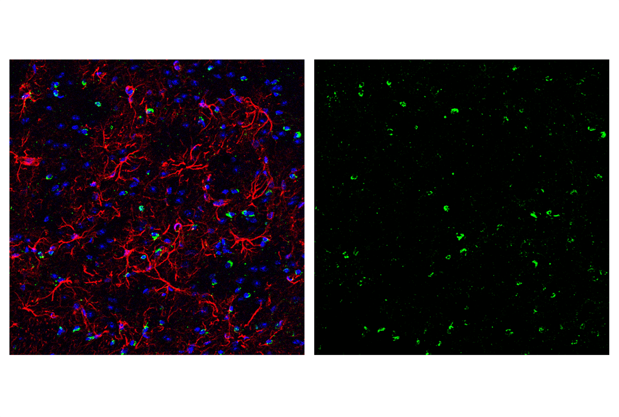 Immunofluorescence Image 6: Smac/Diablo (D5S3R) Rabbit mAb (BSA and Azide Free)