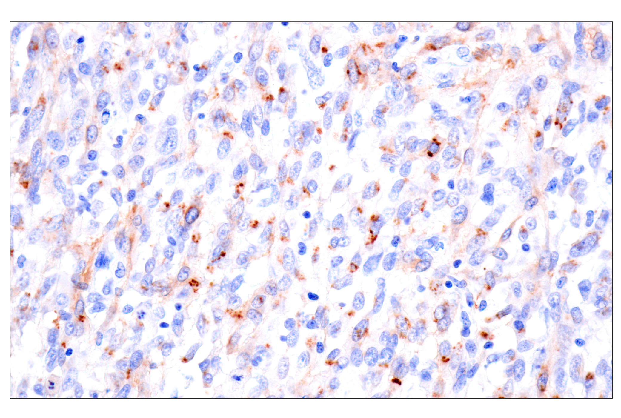 Immunohistochemistry Image 11: FAP (F1A4G) Rabbit mAb (BSA and Azide Free)