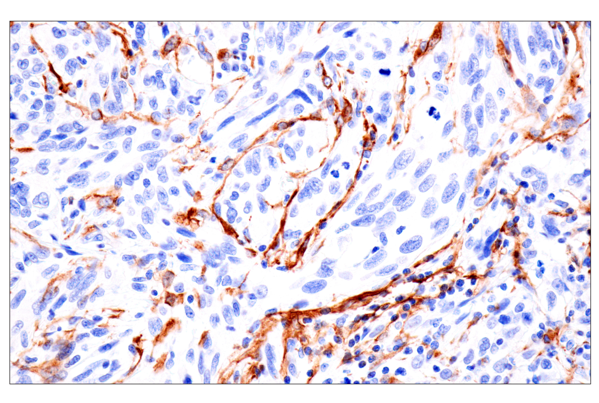 Immunohistochemistry Image 10: FAP (F1A4G) Rabbit mAb (BSA and Azide Free)