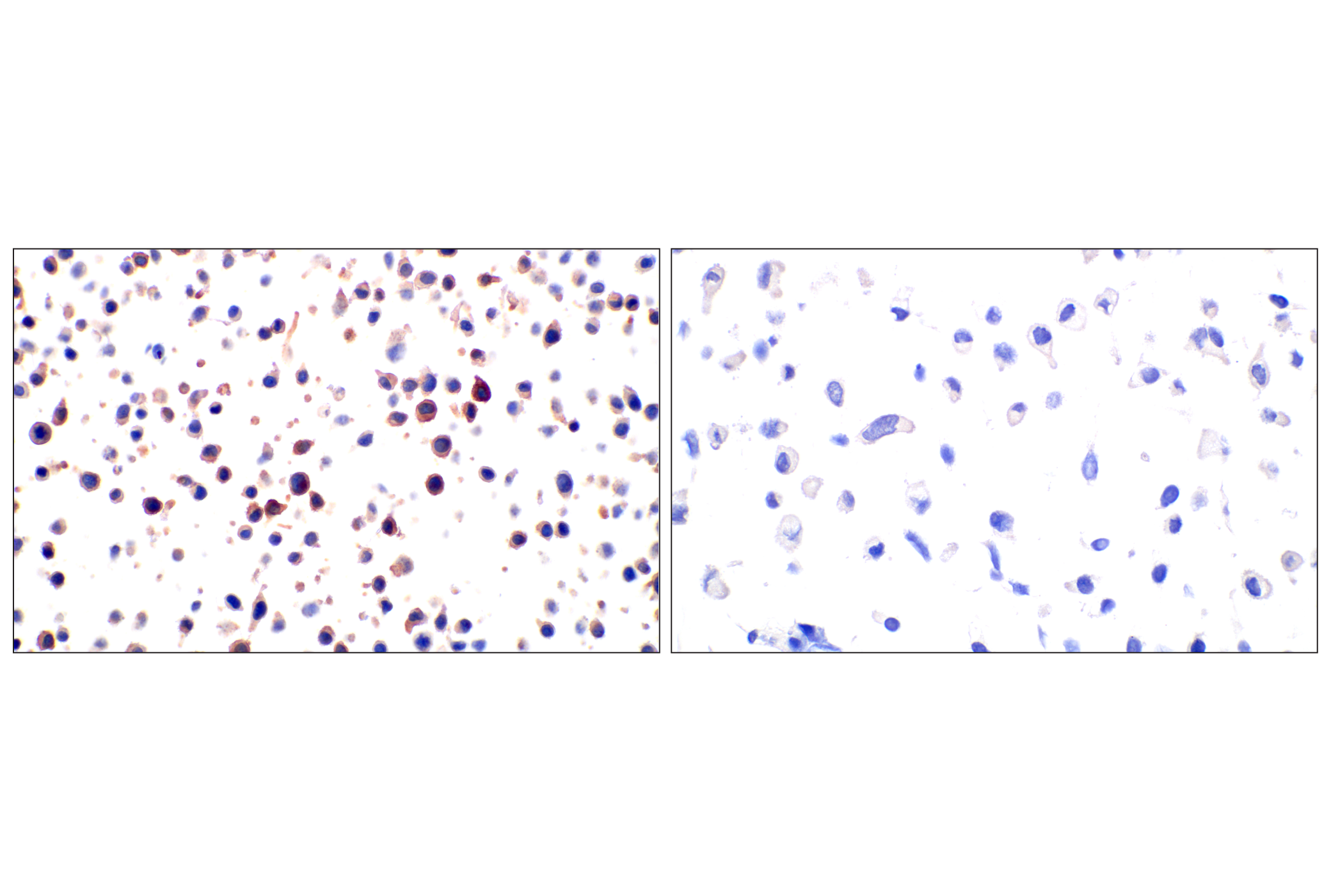 Immunohistochemistry Image 15: FAP (F1A4G) Rabbit mAb (BSA and Azide Free)