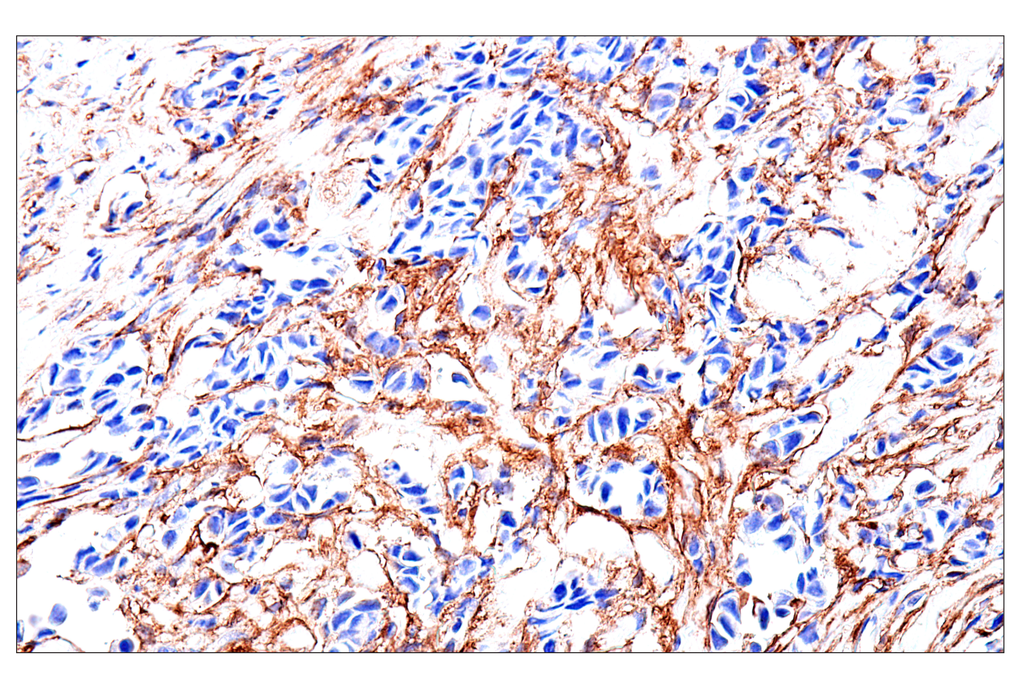 Immunohistochemistry Image 1: FAP (F1A4G) Rabbit mAb (BSA and Azide Free)