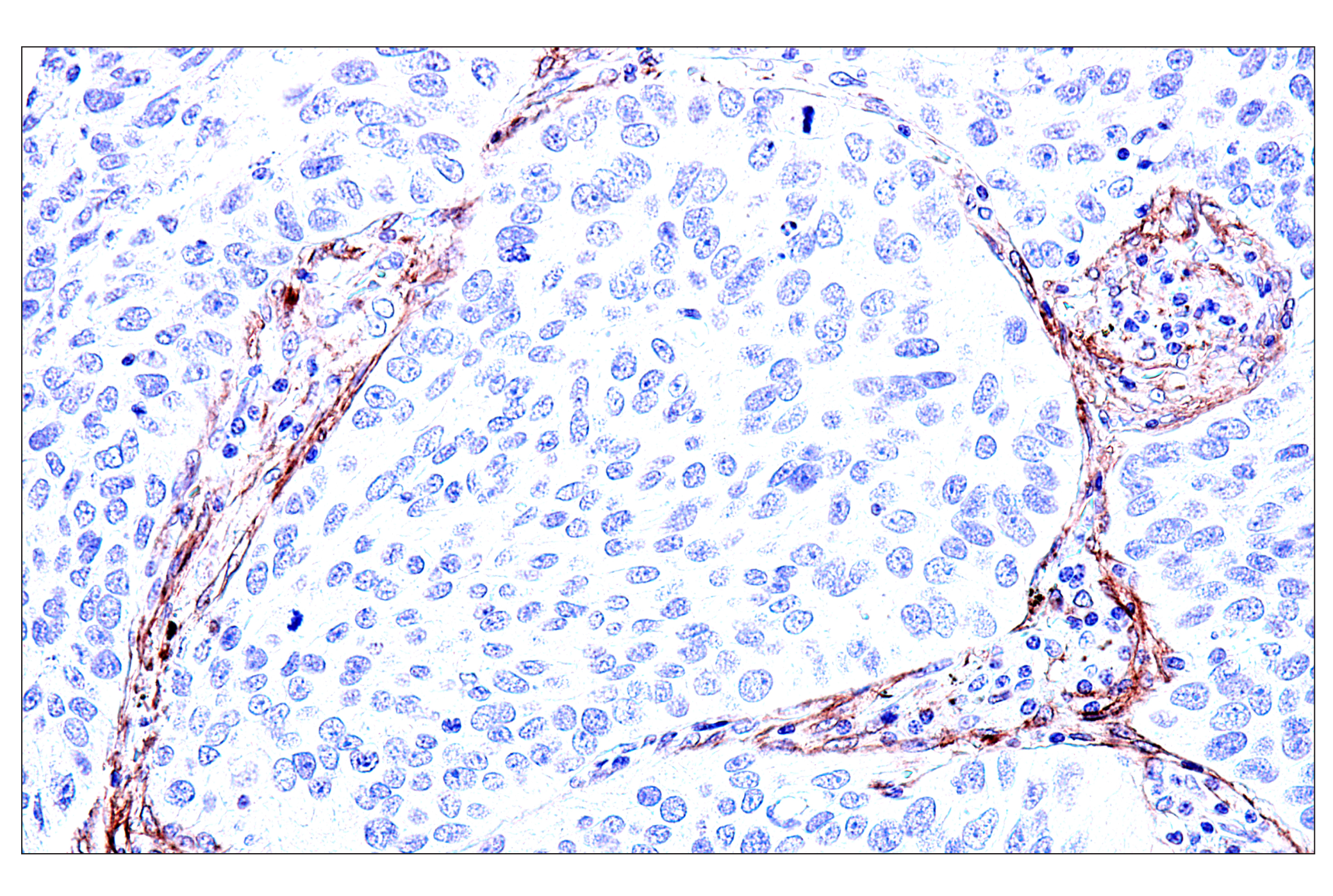 Immunohistochemistry Image 5: FAP (F1A4G) Rabbit mAb (BSA and Azide Free)