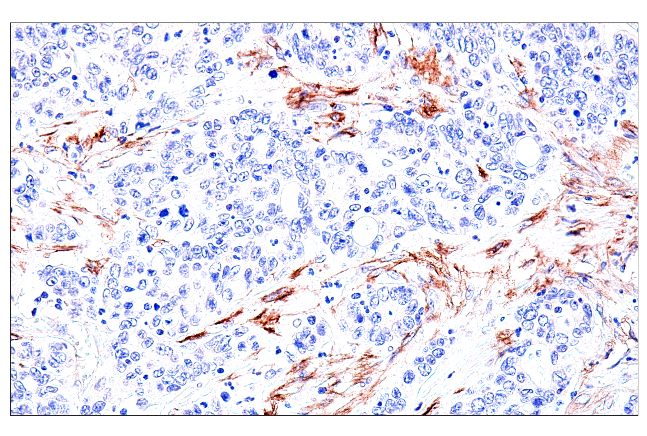 Immunohistochemistry Image 8: FAP (F1A4G) Rabbit mAb (BSA and Azide Free)
