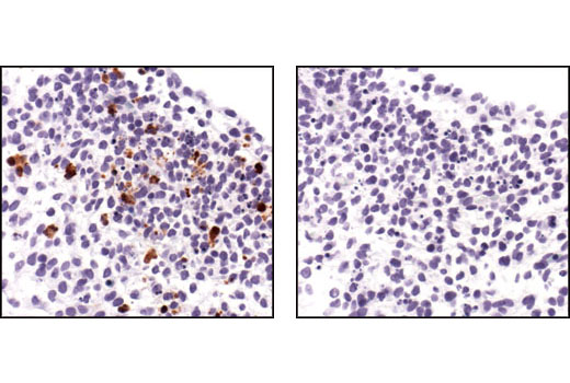 Immunohistochemistry Image 1: Apoptosis Marker: SignalStain® Cleaved Caspase-3 (Asp175) IHC Detection Kit