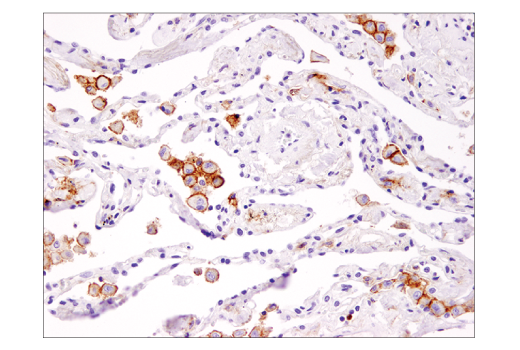Immunohistochemistry Image 2: TIM-3 (D5D5R™) XP® Rabbit mAb (BSA and Azide Free)