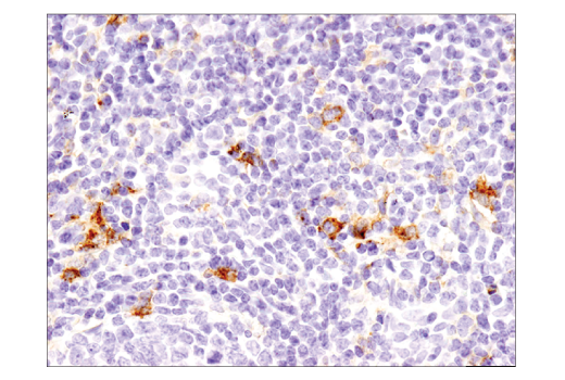 Immunohistochemistry Image 4: TIM-3 (D5D5R™) XP® Rabbit mAb (BSA and Azide Free)