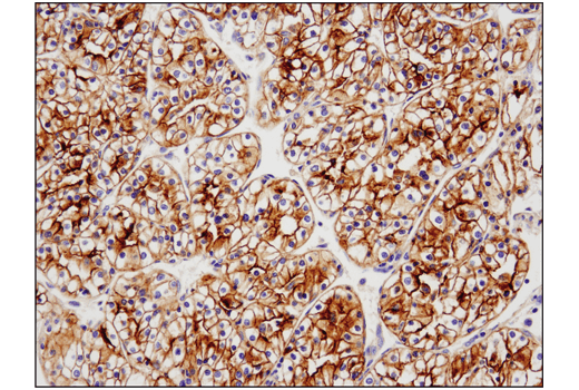 Immunohistochemistry Image 1: TIM-3 (D5D5R™) XP® Rabbit mAb (BSA and Azide Free)