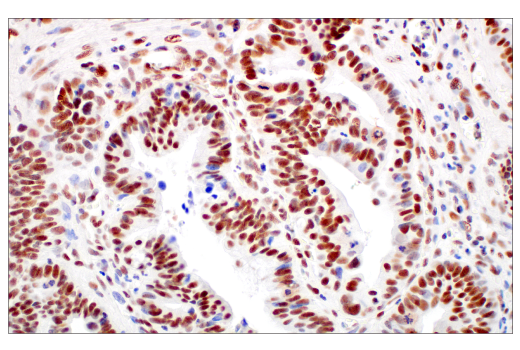 Immunohistochemistry Image 1: p95/NBS1 (E8M3Q) XP® Rabbit mAb