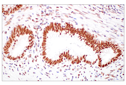 Immunohistochemistry Image 4: p95/NBS1 (E8M3Q) XP® Rabbit mAb