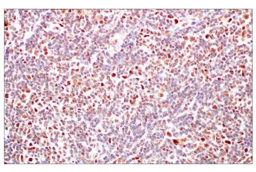 Immunohistochemistry Image 5: p95/NBS1 (E8M3Q) XP® Rabbit mAb