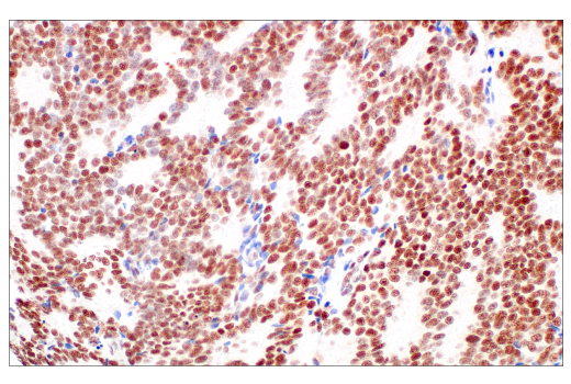 Immunohistochemistry Image 8: p95/NBS1 (E8M3Q) XP® Rabbit mAb